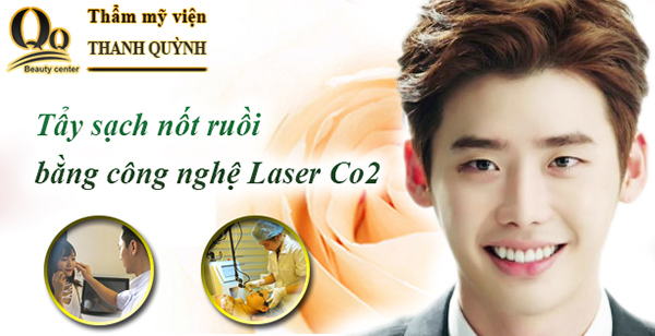 Tẩy nốt ruồi bằng Laser thế hệ mới